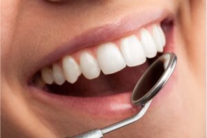 Sonrisa óptima