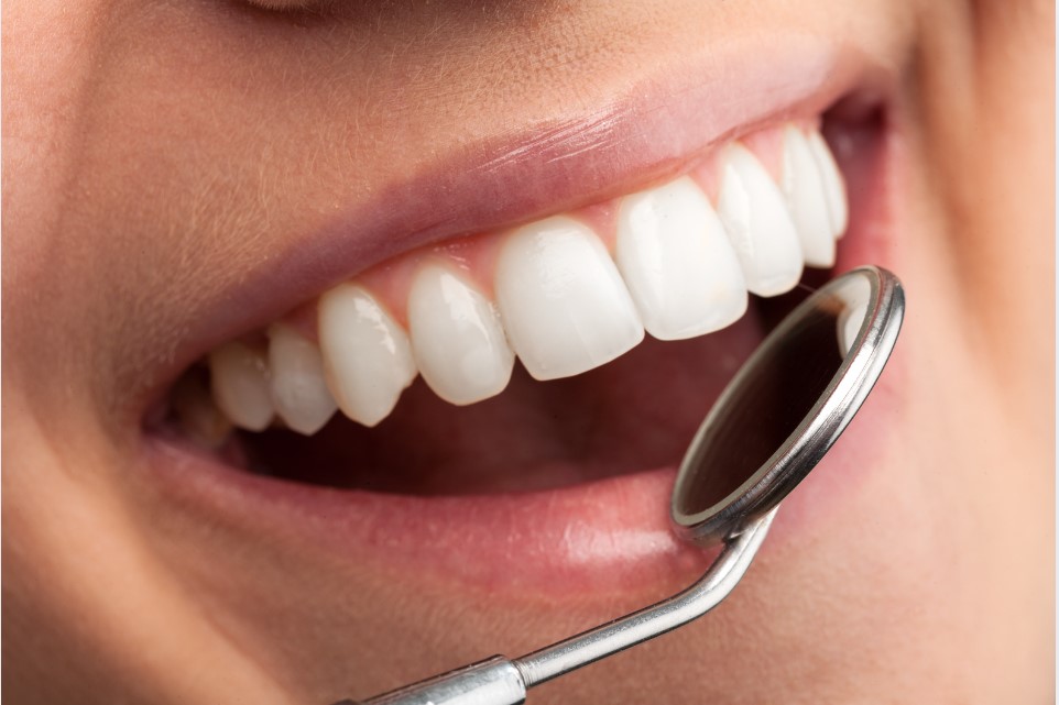 Sonrisa óptima